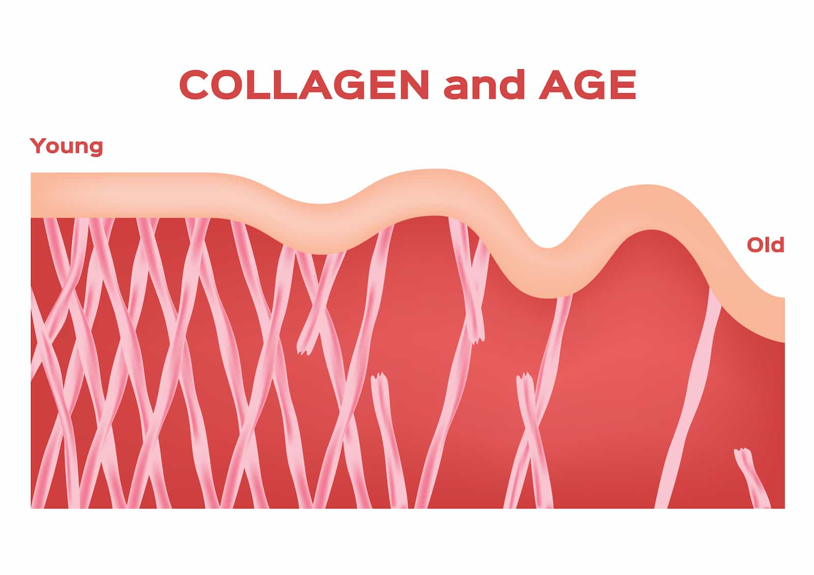 Collagen As We Age Role, Signs, Procedures, Products, and Preventative